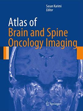 portada Atlas of Brain and Spine Oncology Imaging (en Inglés)