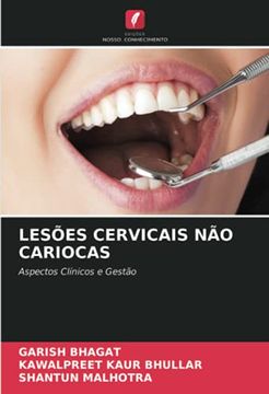 portada Lesões Cervicais não Cariocas: Aspectos Clínicos e Gestão (en Portugués)