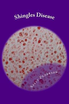 portada Shingles Disease: The Complete Guide (en Inglés)