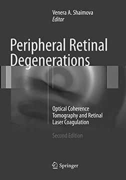 portada Peripheral Retinal Degenerations: Optical Coherence Tomography and Retinal Laser Coagulation (in English)