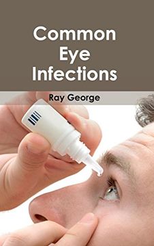 portada Common eye Infections (en Inglés)