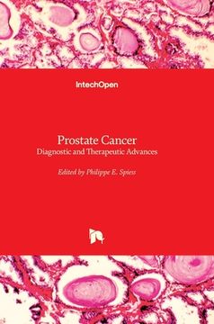 portada Prostate Cancer: Diagnostic and Therapeutic Advances (en Inglés)
