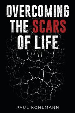 portada Overcoming the Scars of Life (en Inglés)