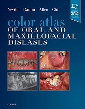 portada Color Atlas of Oral and Maxillofacial Diseases 