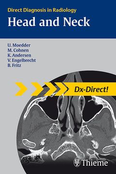 Head and Neck Imaging: Direct Diagnosis in Radiology (en Inglés)