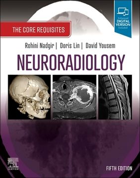 portada Neuroradiology: The Core Requisites (en Inglés)