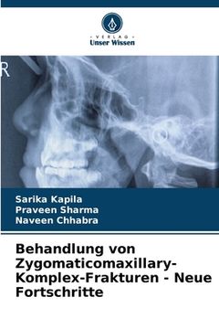 portada Behandlung von Zygomaticomaxillary-Komplex-Frakturen - Neue Fortschritte (en Alemán)