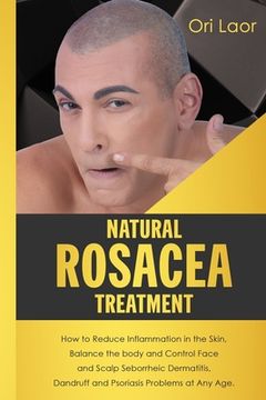 portada Natural Rosacea Treatment: How to Reduce Inflammation in the Skin, Balance the body and Control Face and Scalp Seborrheic Dermatitis, Dandruff an (in English)