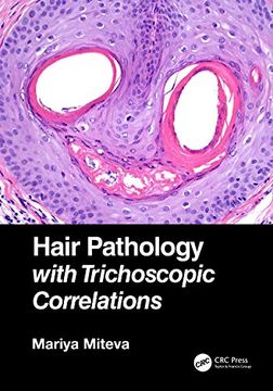 portada Hair Pathology with Trichoscopic Correlations (en Inglés)