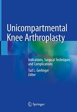 portada Unicompartmental Knee Arthroplasty: Indications, Surgical Techniques and Complications (in English)