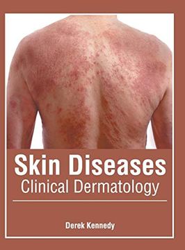 portada Skin Diseases: Clinical Dermatology (en Inglés)