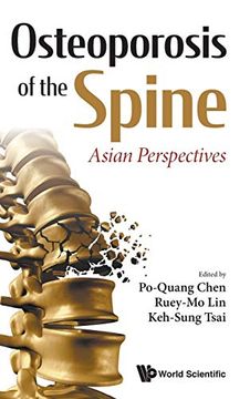 portada Osteoporosis of the Spine: Asian Perspectives (en Inglés)