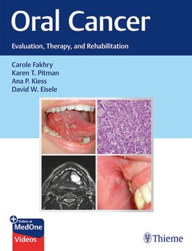 portada Oral Cancer: Evaluation, Therapy, and Rehabilitation (in English)