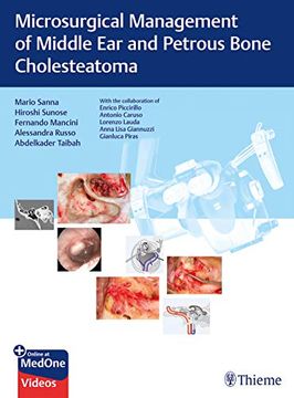 portada Microsurgical Management of Middle ear and Petrous Bone Cholesteatoma (en Inglés)