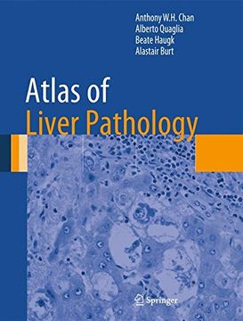 portada Atlas of Liver Pathology (Atlas of Anatomic Pathology) (en Inglés)