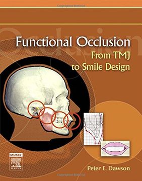portada Functional Occlusion: From tmj to Smile Design, 1e (in English)