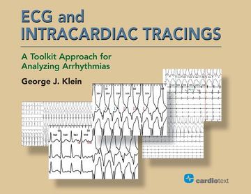 portada ECG and Intracardiac Tracings: A Toolkit Approach for Analyzing Arrhythmias (en Inglés)