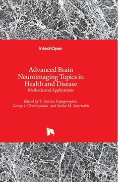 portada Advanced Brain Neuroimaging Topics in Health and Disease: Methods and Applications (en Inglés)