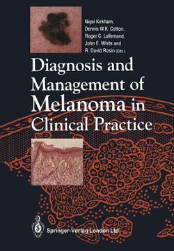 portada Diagnosis and Management of Melanoma in Clinical Practice (in English)