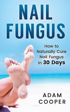 portada Nail Fungus: How to Naturally Cure Nail Fungus in 30 Days: Natural remedies, homeopathy for toenail fungus (en Inglés)