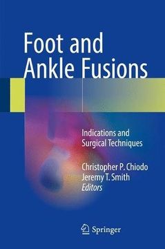 portada Foot and Ankle Fusions: Indications and Surgical Techniques