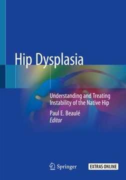 portada Hip Dysplasia: Understanding and Treating Instability of the Native Hip (en Inglés)