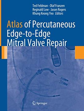 portada Atlas of Percutaneous Edge-To-Edge Mitral Valve Repair (en Inglés)