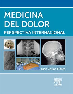 Medicina del Dolor
