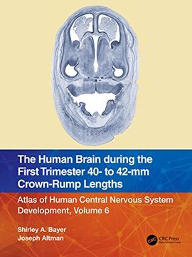 portada The Human Brain During the First Trimester 40- to 42-Mm Crown-Rump Lengths (in English)