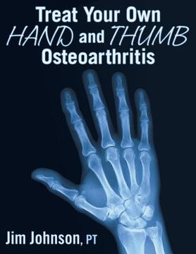 portada Treat Your Own Hand and Thumb Osteoarthritis