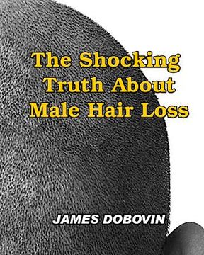 portada The Shocking Truth About Male Hair Loss: Secrets You Need to Know About Losing Hair So You Can Stop From Going Bald (in English)