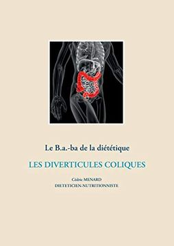 portada Le B. A. -Ba. Diététique Pour les Diverticules Coliques (en Francés)