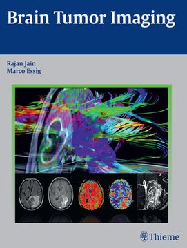 portada Brain Tumor Imaging (en Inglés)