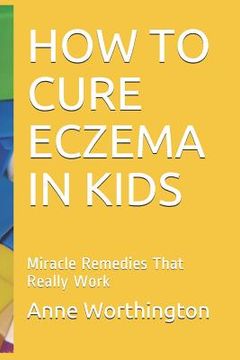 portada How to Cure Eczema in Kids: Miracle Remedies That Really Work (en Inglés)