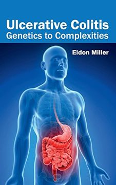 portada Ulcerative Colitis: Genetics to Complexities (in English)