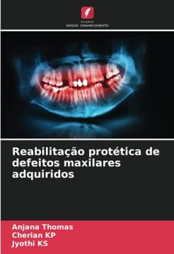 portada Reabilitação Protética de Defeitos Maxilares Adquiridos (in Portuguese)