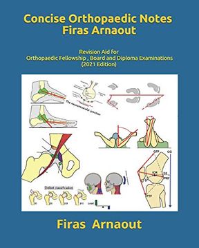 portada Concise Orthopaedic Notes: Revision aid for Frcs , Ebot , Sicot and Board Examinations (en Inglés)