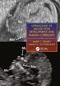 portada Ultrasound of Mouse Fetal Development and Human Correlates (en Inglés)