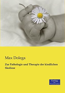 portada Zur Pathologie und Therapie der kindlichen Skoliose (German Edition)