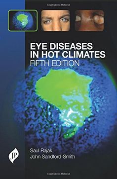 portada Eye Diseases in Hot Climates