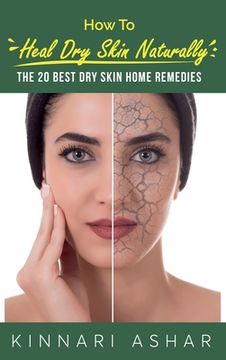 portada How to Heal Dry Skin Naturally: The 20 Best Dry Skin Home Remedies (en Inglés)