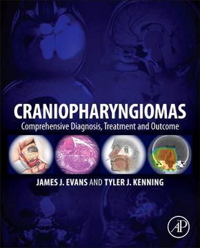 portada Craniopharyngiomas: Comprehensive Diagnosis, Treatment and Outcome