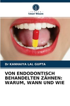portada Von Endodontisch Behandelten Zähnen: Warum, Wann Und Wie (en Alemán)