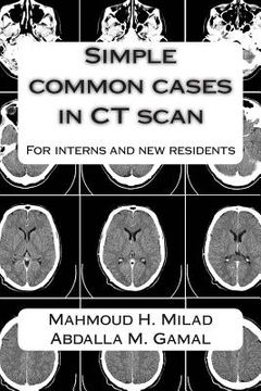 portada Simple common cases in CT scan: For interns and new residents (en Inglés)