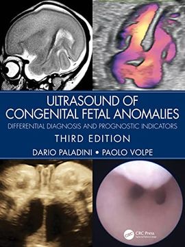 portada Ultrasound of Congenital Fetal Anomalies: Differential Diagnosis and Prognostic Indicators (en Inglés)