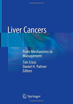 portada Liver Cancers: From Mechanisms to Management (en Inglés)