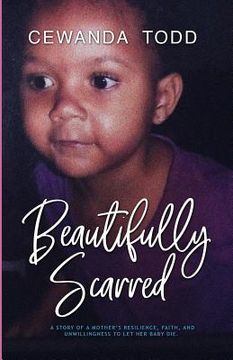 portada Beautifully Scarred: A Story of a Mother's Resilience, Faith, and Unwillingness to Let Her Baby Die.