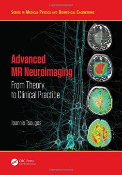 portada Advanced MR Neuroimaging: From Theory to Clinical Practice (Series in Medical Physics and Biomedical Engineering)