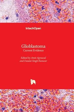 portada Glioblastoma - Current Evidence (en Inglés)