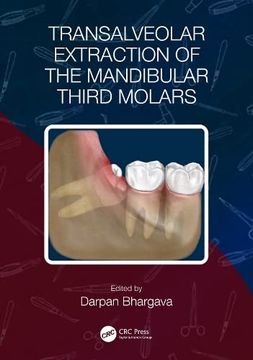 portada Transalveolar Extraction of the Mandibular Third Molars (en Inglés)